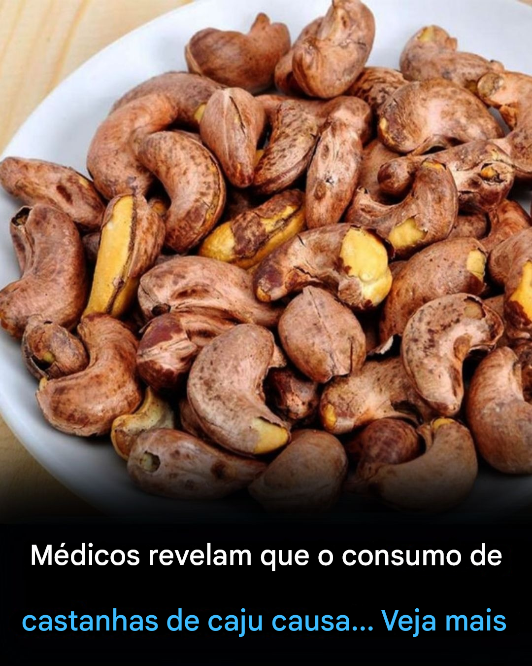 Médicos revelam que o consumo de castanhas de caju causa