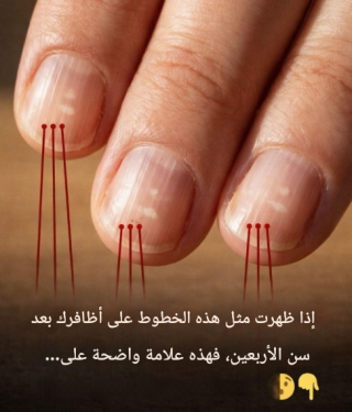 Alimentos que fortalecem as unhas após os 40 anos