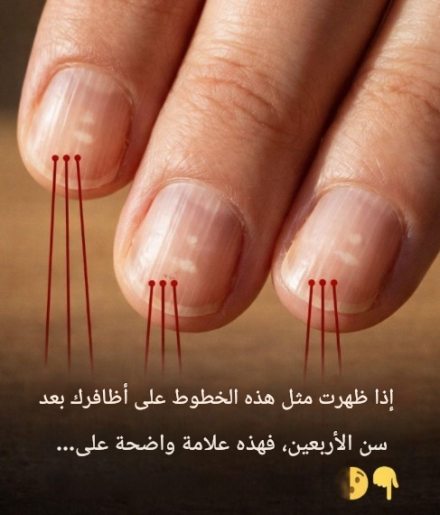 Alimentos que fortalecem as unhas após os 40 anos