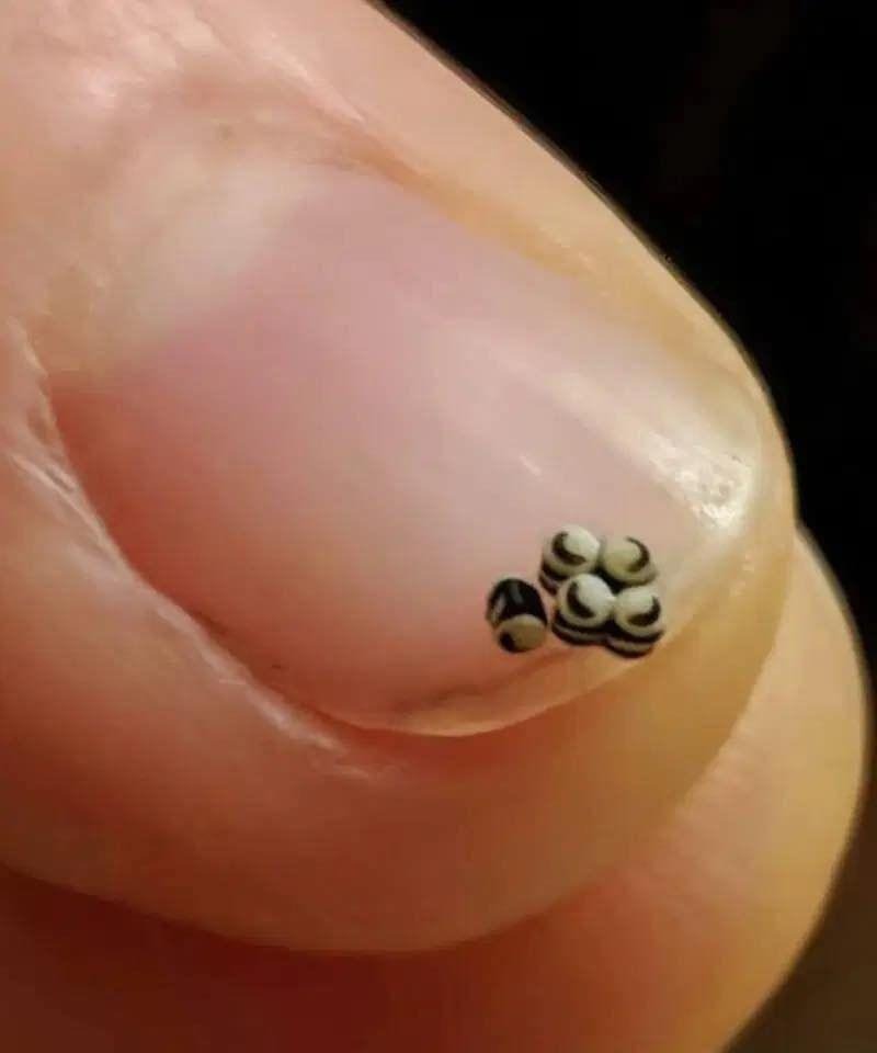 Pedimos uma salada, mas havia minúsculos pontos pretos na comida – fomos direto para o hospital.