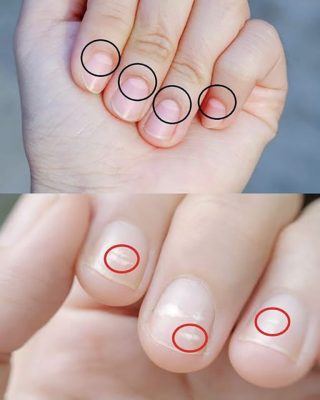 As luas crescentes nas unhas revelam nosso estado de saúde.