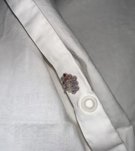 Encontré estas pequeñas canicas en mi cama y casi me da infarto: os voy a contar lo que eran.