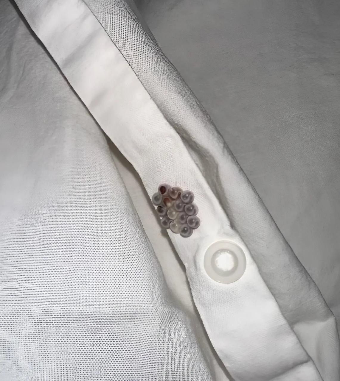 Encontré estas pequeñas canicas en mi cama y casi me da infarto: os voy a contar lo que eran.