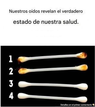 Nuestros oídos revelan el verdadero estado de nuestra salud.