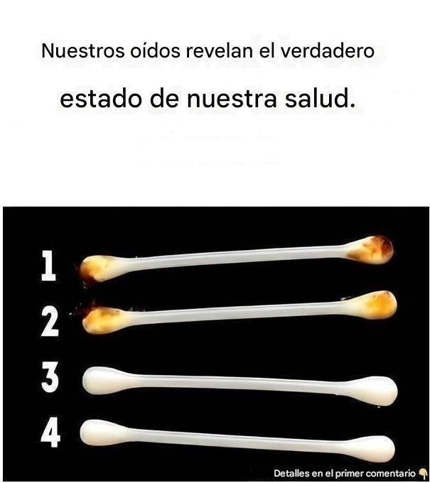 Nuestros oídos revelan el verdadero estado de nuestra salud.