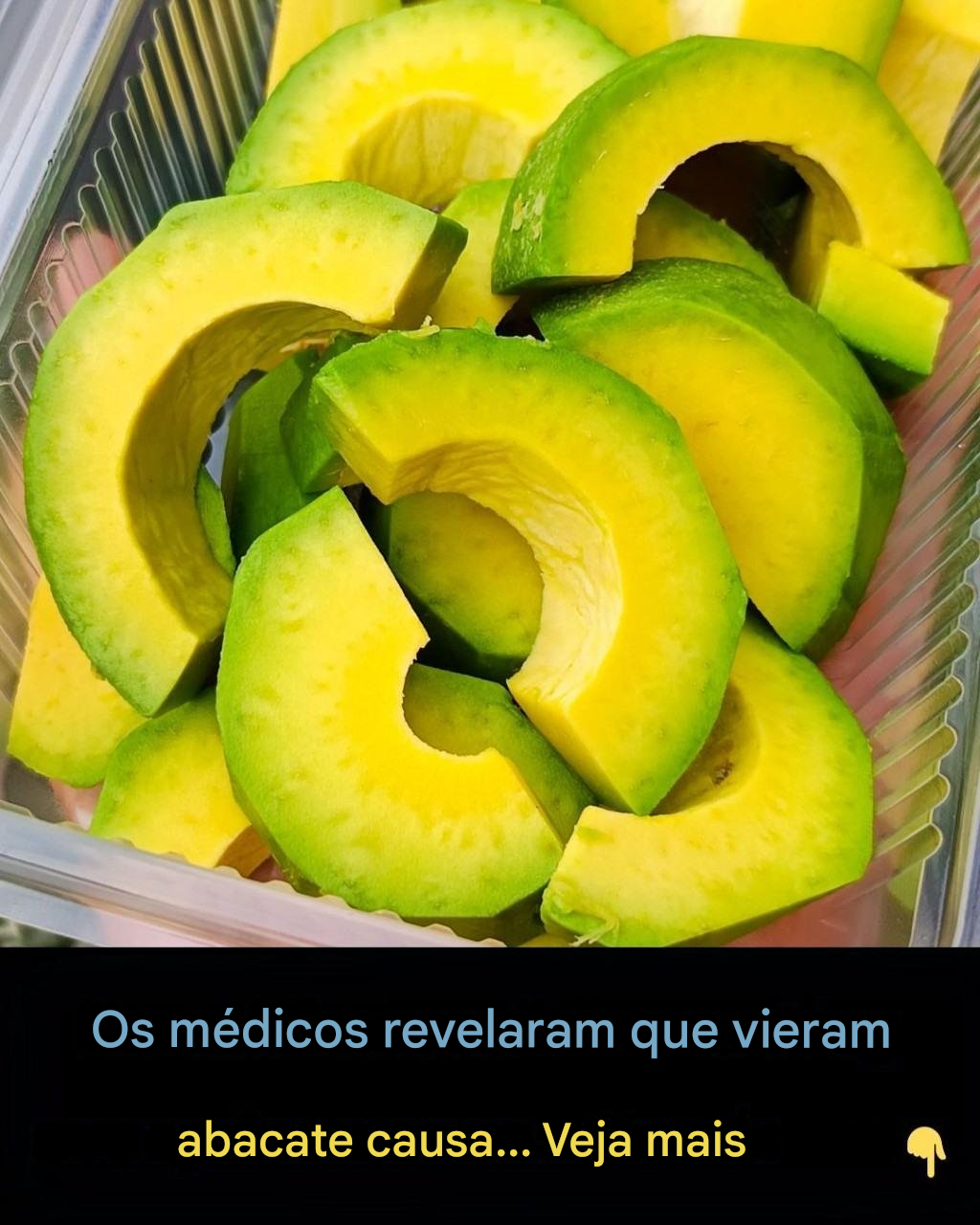 Benefícios comprovados cientificamente para a saúde do abacate e das sementes de abacate.