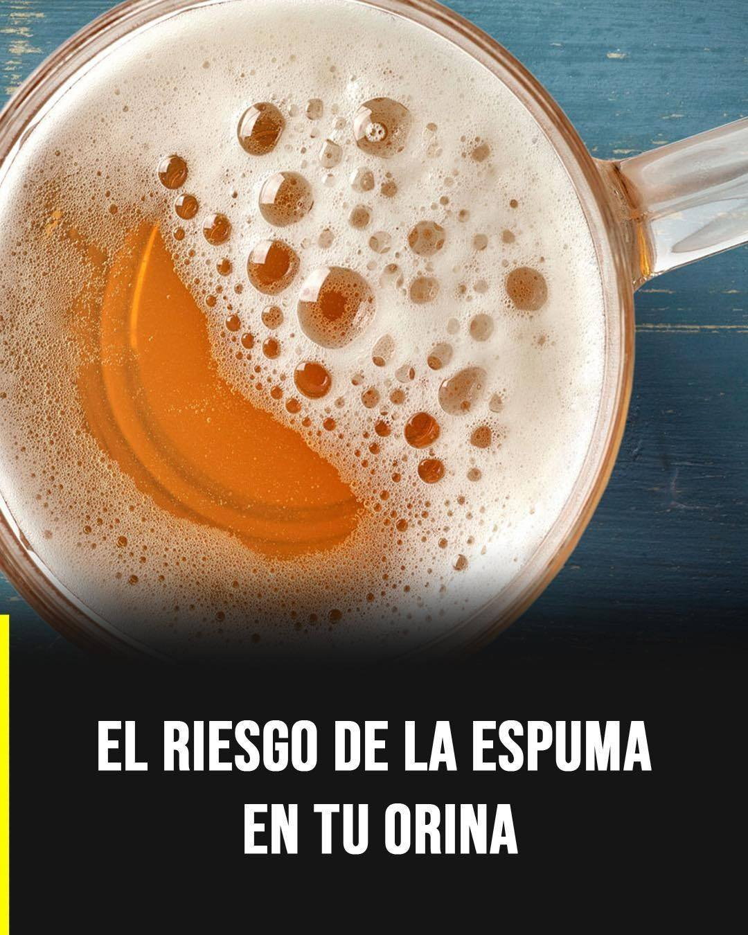 El riesgo de la espuma en tu orina: cuándo es una señal de alerta y cuándo no